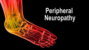 Peripheral Neuropathy