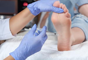 PRP Treatments